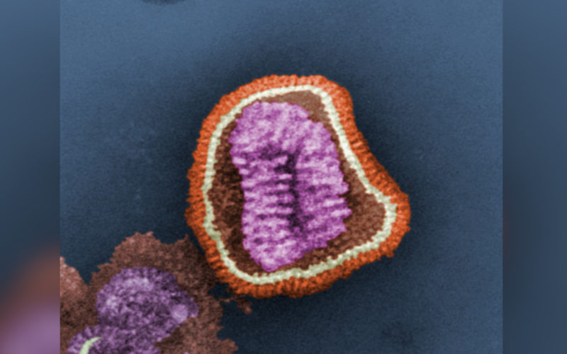 Grippevirus unter dem Elektronenmikroskop. Stark rundes Rechteck mit zweischichtiger Hülle. Ganz außen die Spikeproteine, darunter etwa halb so dünn die eigentliche Hülle. Im Innenraum wurstartige Struktur, welche das Genom enthält.