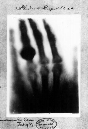 X-ray of a hand taken by Wilhelm Röntgen. The bones are dark on a white background. A black octagon on the ring finger comes from a ring. A hand written text above the x-ray reads "Hand mit Ringen". 